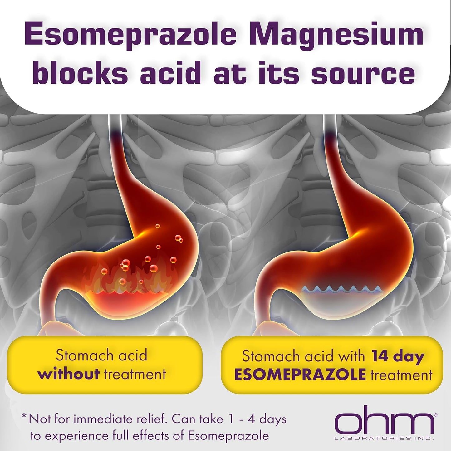 Lot of 5 - Ohm Esomeprazole Magnesium 20mg Acid Reducer 28 Caps by Ohm